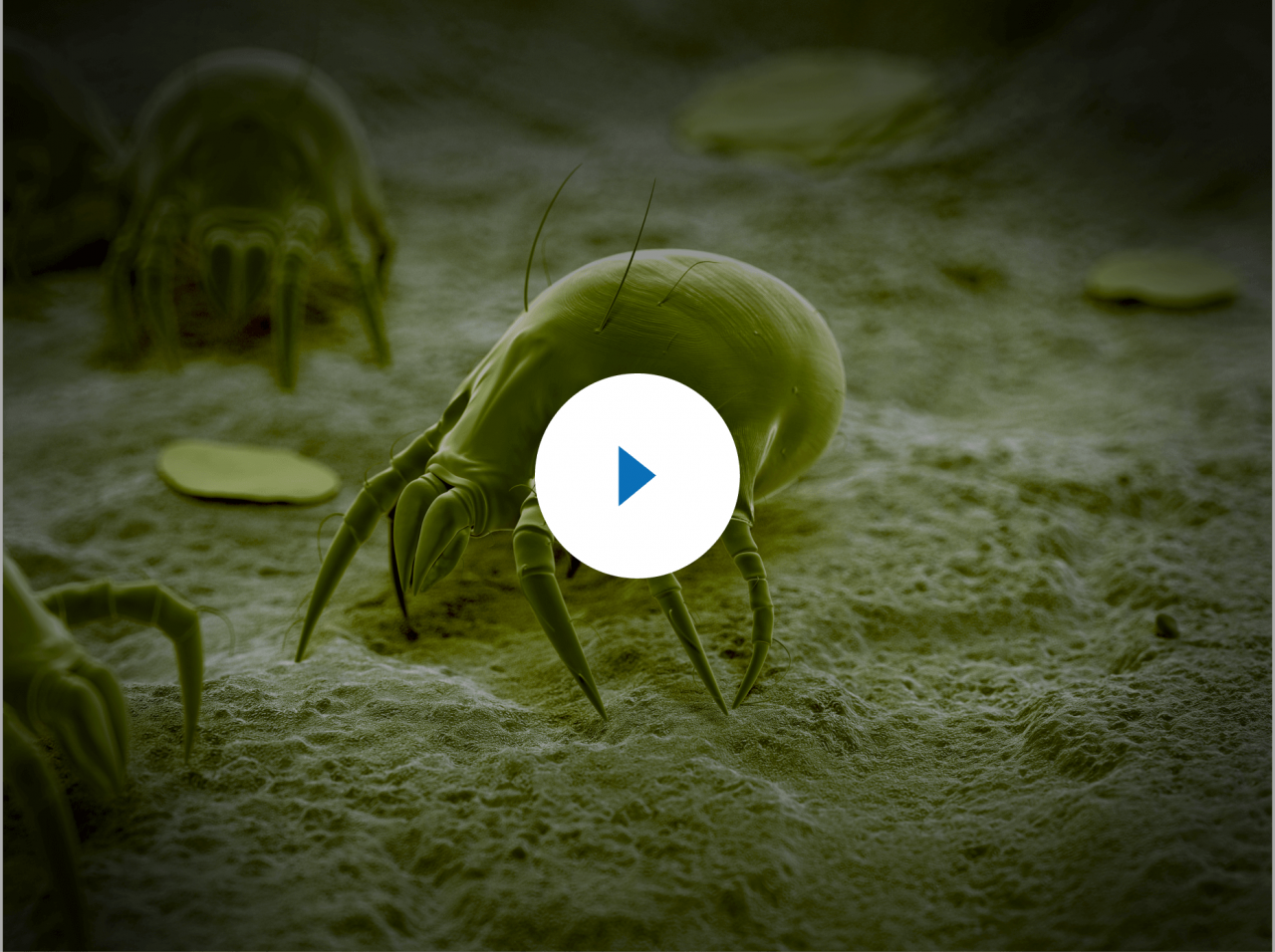 Anti Dust Mite House Dust Mite Dust Mites Treatments